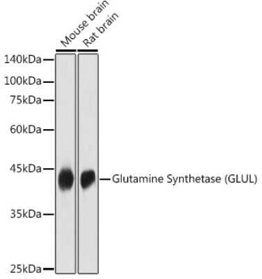 Western Blot: Glutamine Synthetase AntibodyBSA Free [NBP3-03471]